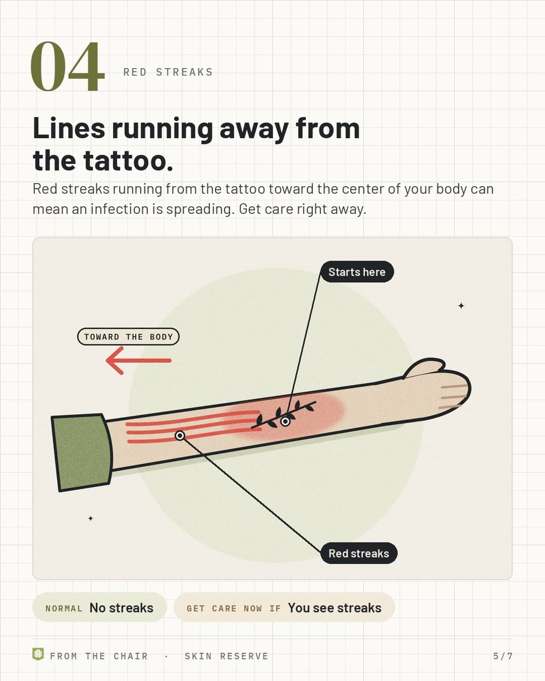 Red streaks: red lines running from an arm tattoo toward the body